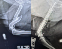 A before-and-after view of orthopedic surgery